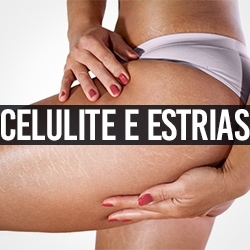 Celulite e Estrias